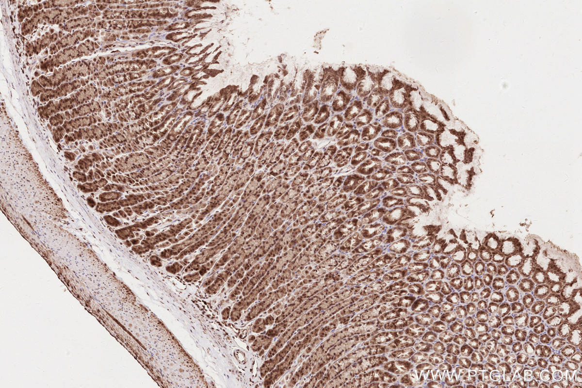 Immunohistochemistry (IHC) staining of rat stomach tissue using VRK2 Polyclonal antibody (12946-1-AP)