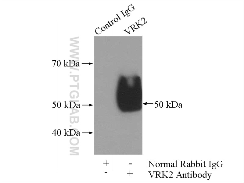 Immunoprecipitation (IP) experiment of K-562 cells using VRK2 Polyclonal antibody (12946-1-AP)