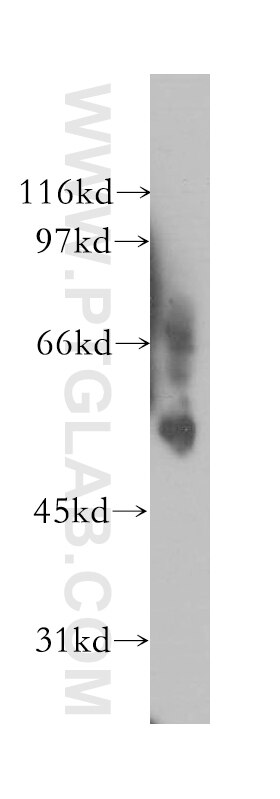 Western Blot (WB) analysis of mouse skeletal muscle tissue using VRK2 Polyclonal antibody (12946-1-AP)