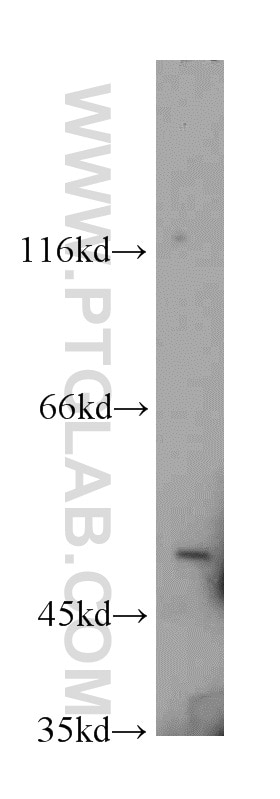 Western Blot (WB) analysis of HeLa cells using VRK3 Polyclonal antibody (15608-1-AP)