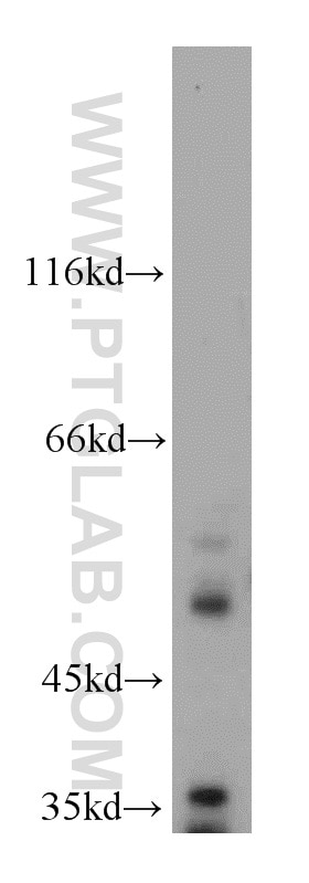 Western Blot (WB) analysis of HeLa cells using VRK3 Polyclonal antibody (15608-1-AP)