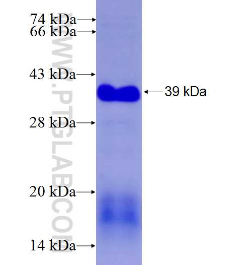VRK3 fusion protein Ag7993 SDS-PAGE