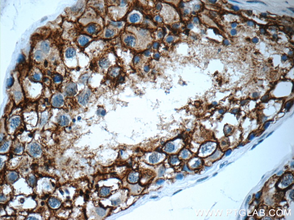 Immunohistochemistry (IHC) staining of human testis tissue using VSIG1 Polyclonal antibody (14145-1-AP)