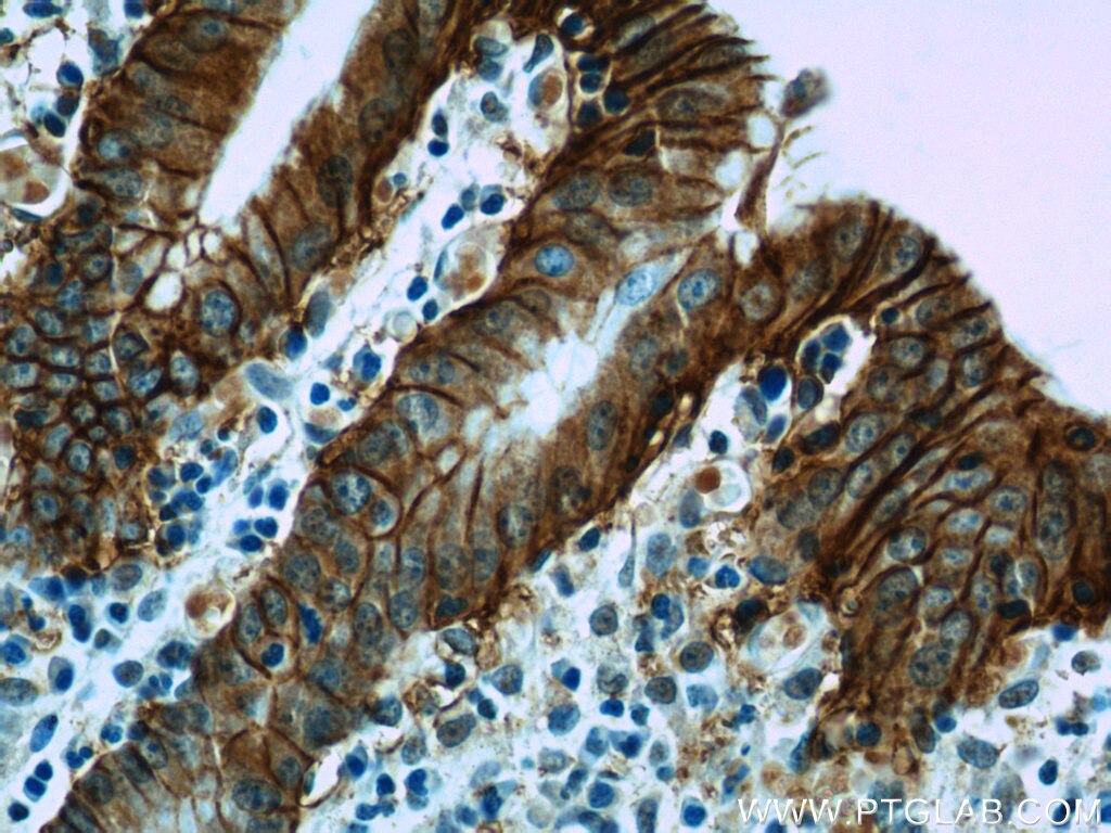 Immunohistochemistry (IHC) staining of human stomach tissue using VSIG1 Polyclonal antibody (14145-1-AP)