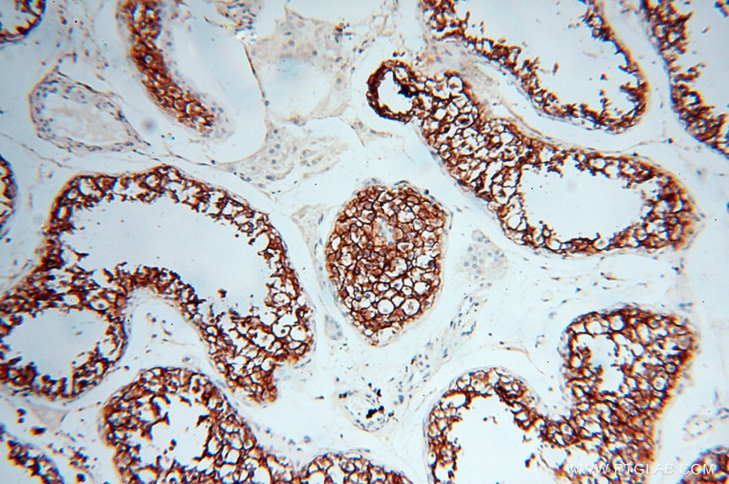 IHC staining of human testis using 14145-1-AP