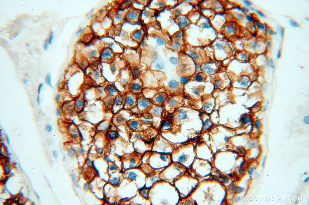 Immunohistochemistry (IHC) staining of human testis tissue using VSIG1 Polyclonal antibody (14145-1-AP)