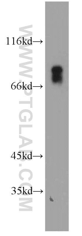 Western Blot (WB) analysis of human stomach tissue using VSIG1 Polyclonal antibody (14145-1-AP)