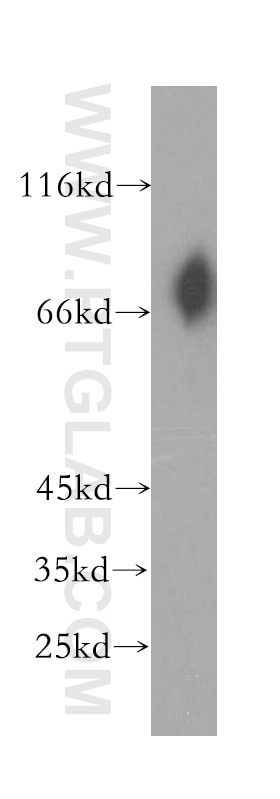 Western Blot (WB) analysis of human stomach tissue using VSIG1 Polyclonal antibody (14145-1-AP)