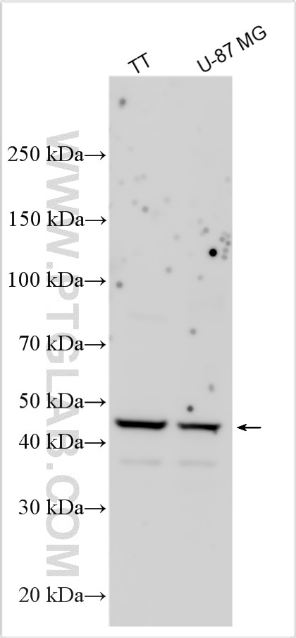 Western Blot (WB) analysis of various lysates using VSIG4 Polyclonal antibody (27829-1-AP)