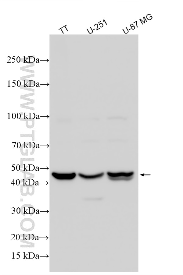 Western Blot (WB) analysis of various lysates using VSIG4 Polyclonal antibody (27829-1-AP)