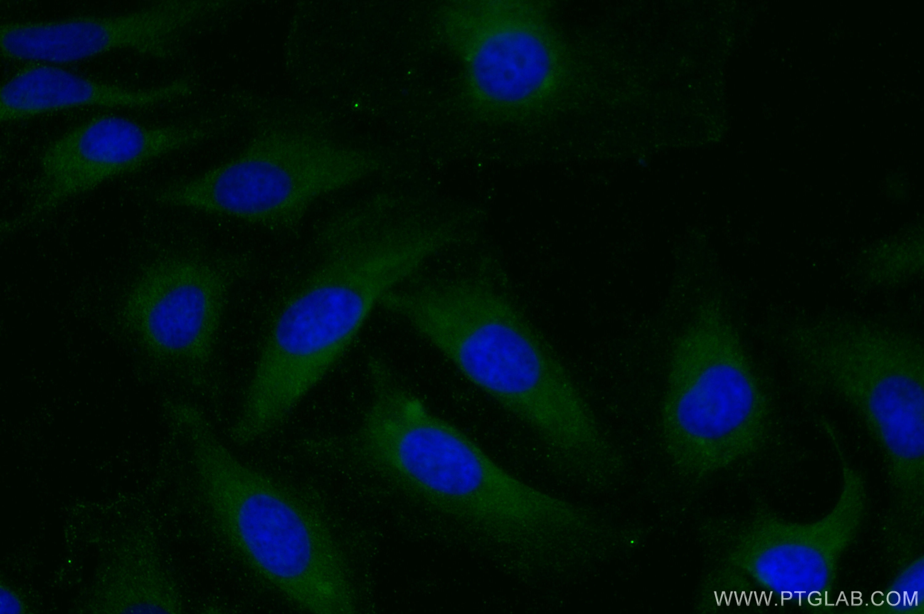 Immunofluorescence (IF) / fluorescent staining of HeLa cells using VILIP-1 Polyclonal antibody (13919-1-AP)
