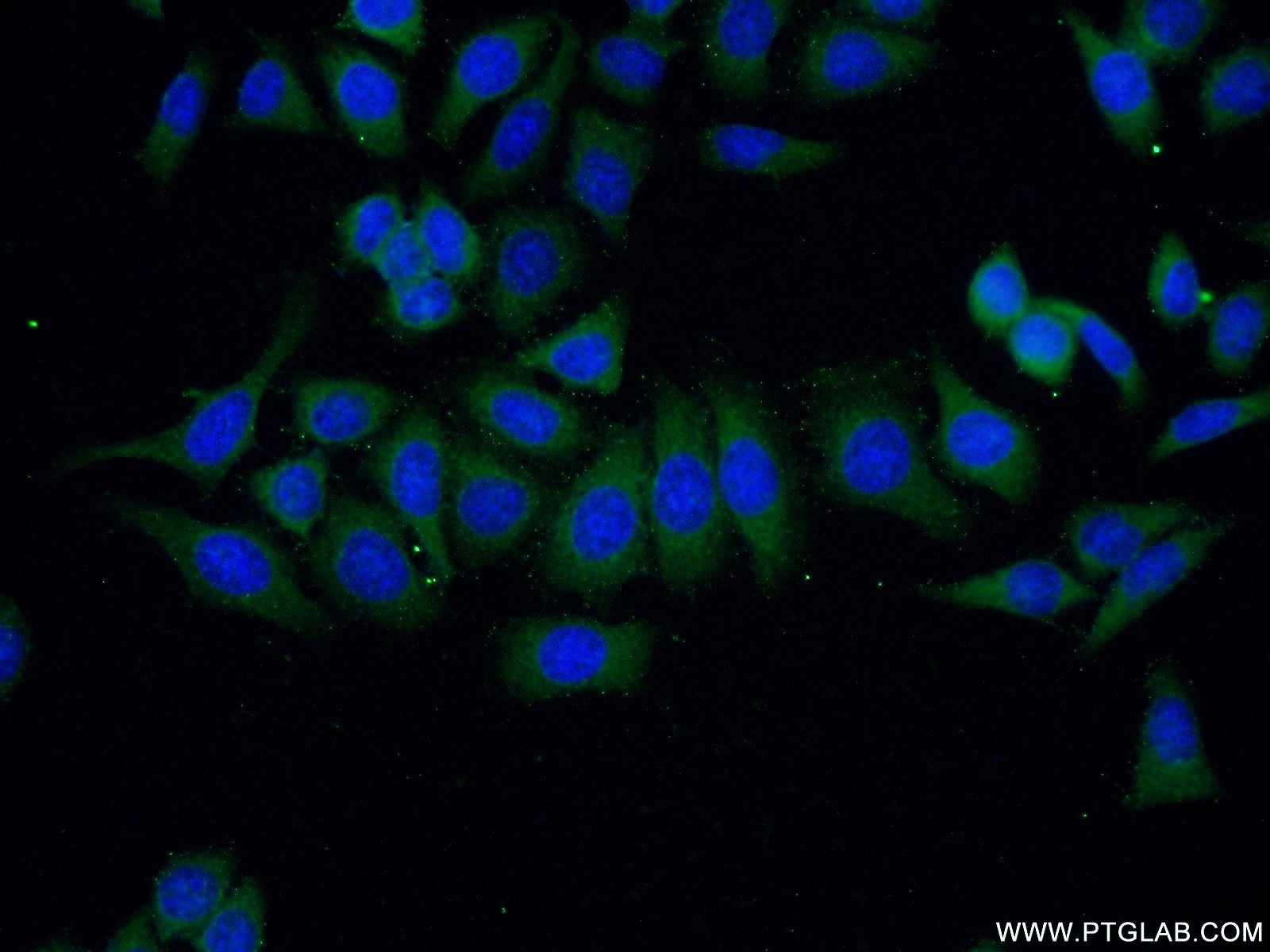 Immunofluorescence (IF) / fluorescent staining of HeLa cells using VILIP-1 Polyclonal antibody (13919-1-AP)