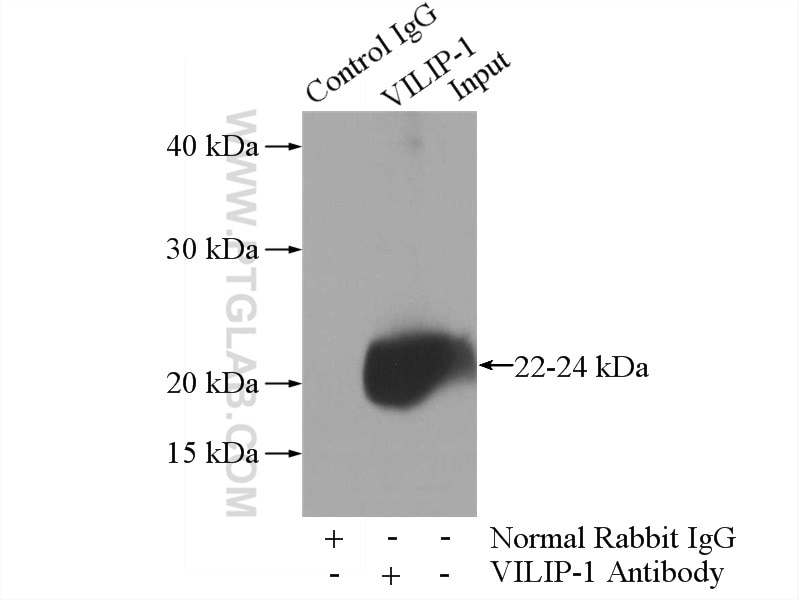 Immunoprecipitation (IP) experiment of mouse brain tissue using VILIP-1 Polyclonal antibody (13919-1-AP)