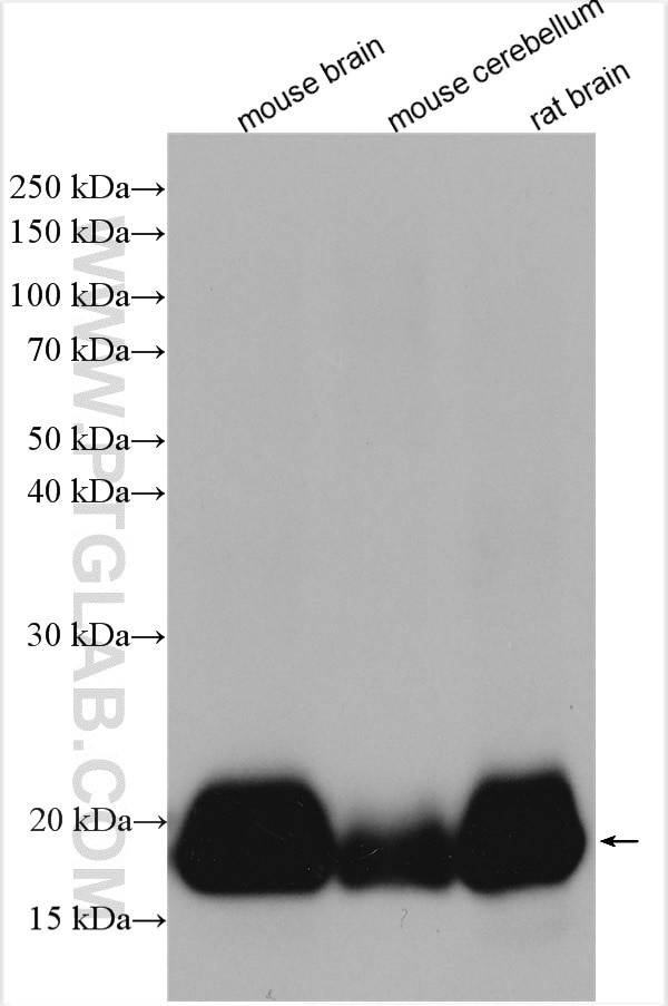 Western Blot (WB) analysis of various lysates using VILIP-1 Polyclonal antibody (13919-1-AP)