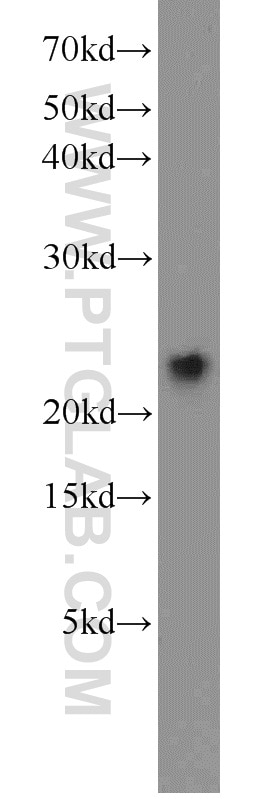 Western Blot (WB) analysis of mouse tongue tissue using VILIP-1 Polyclonal antibody (13919-1-AP)