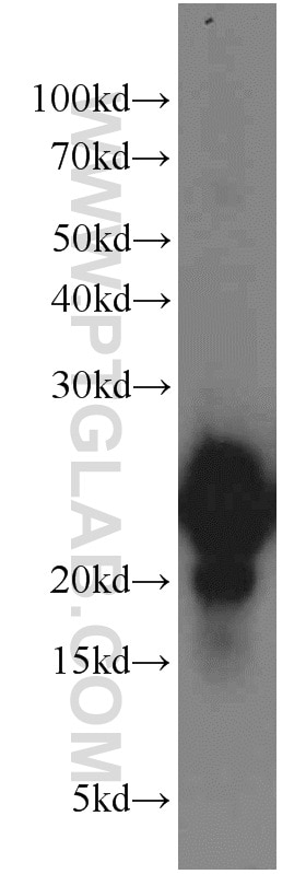 Western Blot (WB) analysis of human brain tissue using VILIP-1 Polyclonal antibody (13919-1-AP)