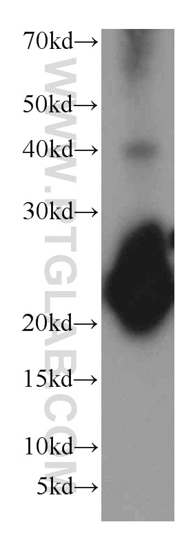 Western Blot (WB) analysis of rat brain tissue using VILIP-1 Polyclonal antibody (13919-1-AP)