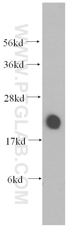 Western Blot (WB) analysis of HeLa cells using VILIP-1 Polyclonal antibody (13919-1-AP)