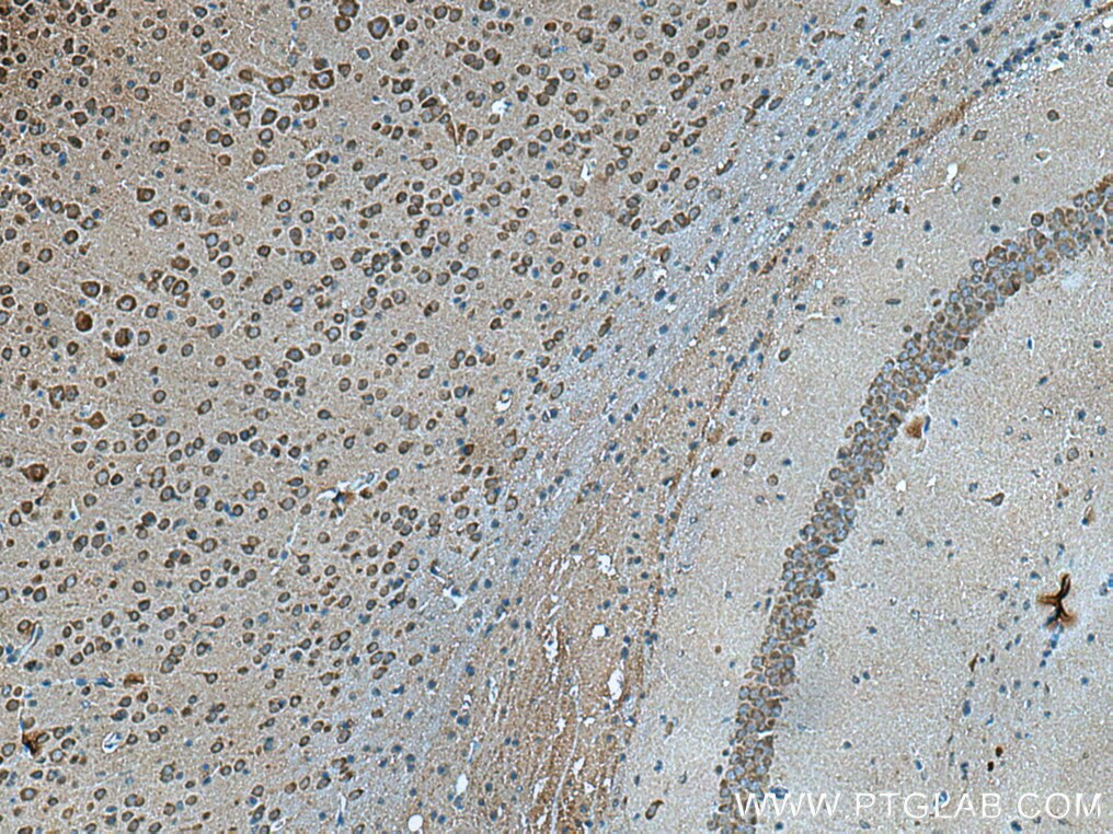 Immunohistochemistry (IHC) staining of mouse brain tissue using VSNL1 Monoclonal antibody (67134-1-Ig)