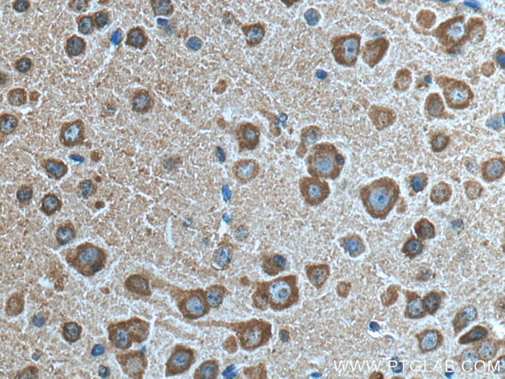 Immunohistochemistry (IHC) staining of mouse brain tissue using VSNL1 Monoclonal antibody (67134-1-Ig)