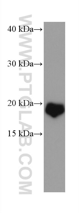 Western Blot (WB) analysis of human brain tissue using VSNL1 Monoclonal antibody (67134-1-Ig)