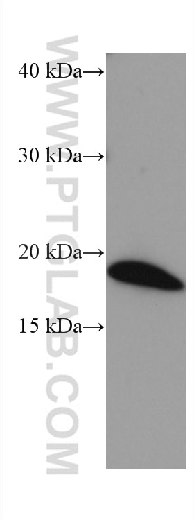 Western Blot (WB) analysis of rat brain tissue using VSNL1 Monoclonal antibody (67134-1-Ig)