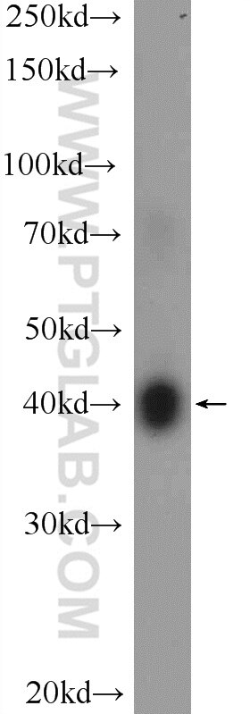 Western Blot (WB) analysis of HL-60 cells using VSTM1 Polyclonal antibody (24382-1-AP)