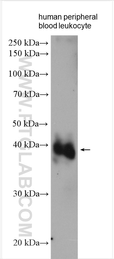 Western Blot (WB) analysis of various lysates using VSTM1 Polyclonal antibody (24382-1-AP)