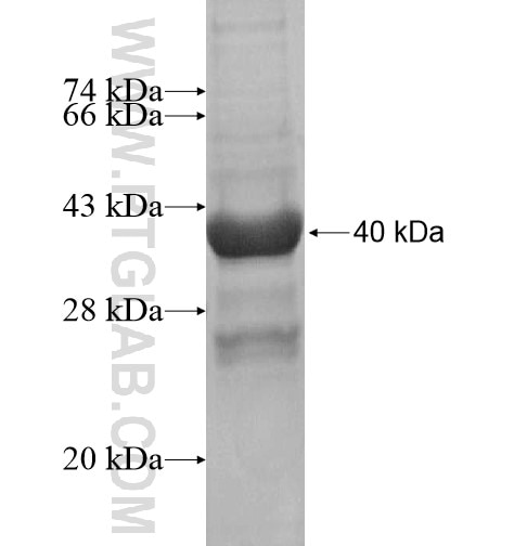 VSTM1 fusion protein Ag15799 SDS-PAGE