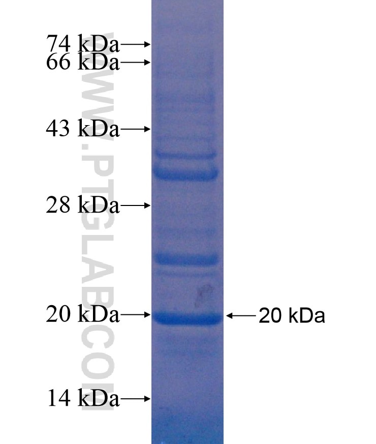 VSTM1 fusion protein Ag17182 SDS-PAGE