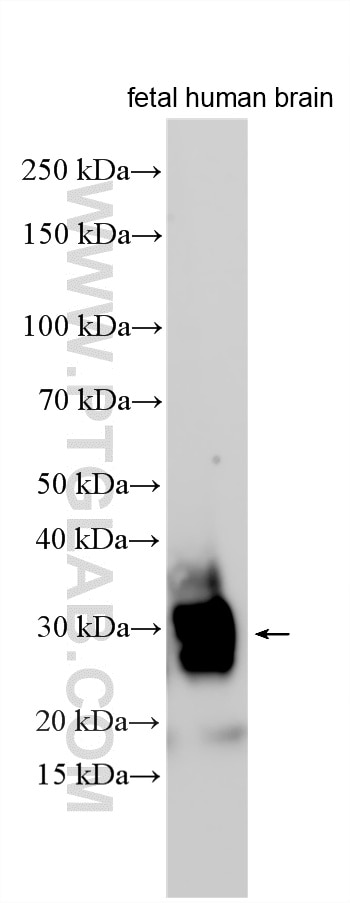 Fetal human brain tissue were subjected to SDS PAGE followed by western blot with 33423-1-AP (VSTM2B antibody) at dilution of 1:1000 incubated at room temperature for 1.5 hours. Western Blot (WB) analysis of various lysates using VSTM2B Polyclonal antibody (33423-1-AP)