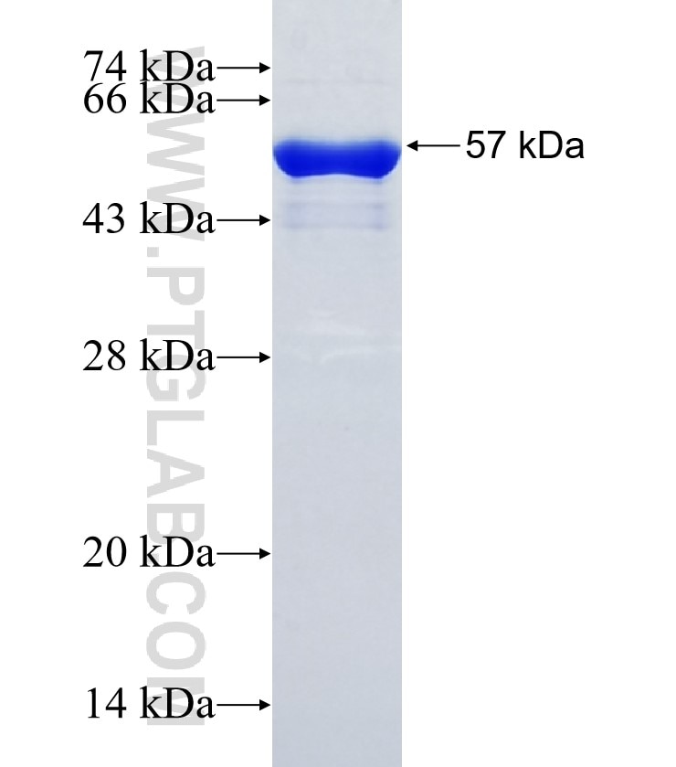 VSTM2B fusion protein Ag35220 SDS-PAGE VSTM2B fusion protein Ag35220 SDS-PAGE