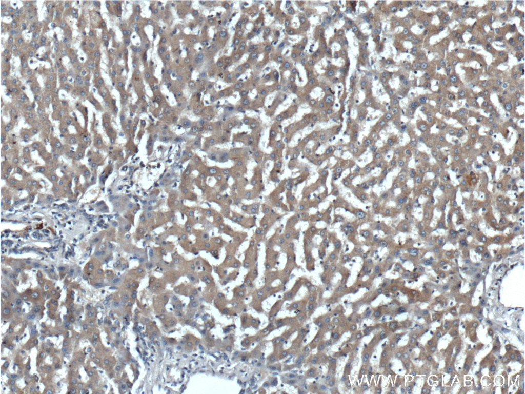 Immunohistochemistry (IHC) staining of human liver tissue using VSTM2L Polyclonal antibody (25457-1-AP)