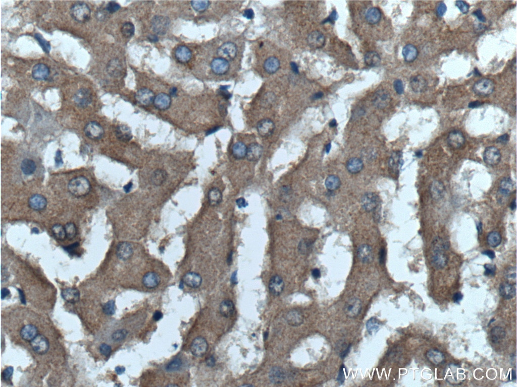 Immunohistochemistry (IHC) staining of human liver tissue using VSTM2L Polyclonal antibody (25457-1-AP)