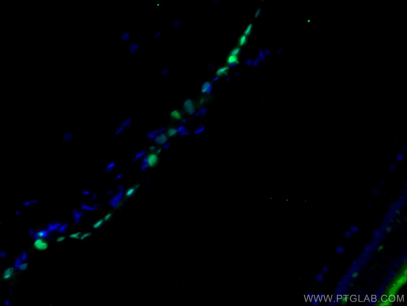 Immunofluorescence (IF) / fluorescent staining of mouse eye tissue using VSX1 Polyclonal antibody (23566-1-AP)
