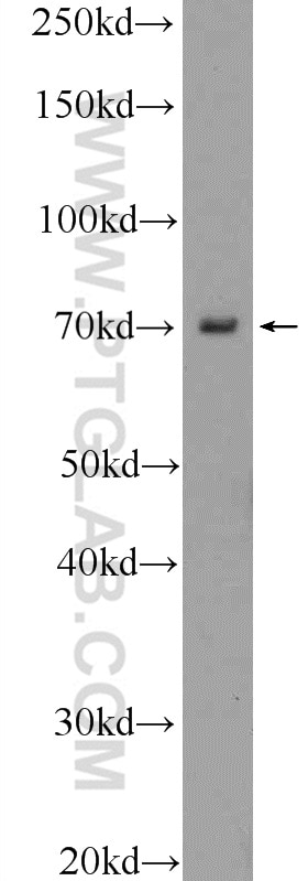 Western Blot (WB) analysis of mouse eye tissue using VSX1 Polyclonal antibody (23566-1-AP)