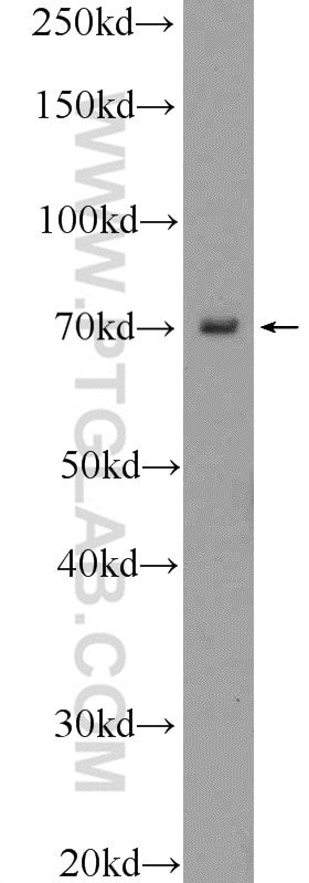 Western Blot (WB) analysis of mouse eye tissue using VSX1 Polyclonal antibody (23566-1-AP)