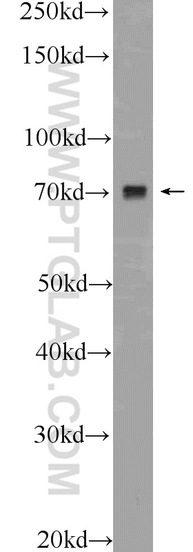 Western Blot (WB) analysis of Raji cells using VSX1 Polyclonal antibody (23566-1-AP)