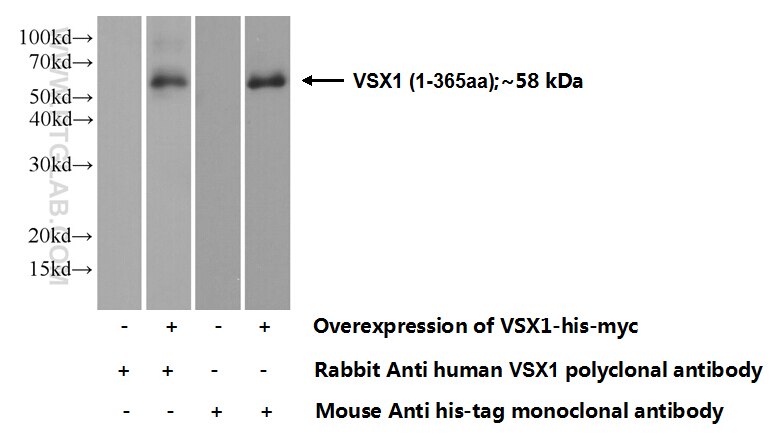 VSX1