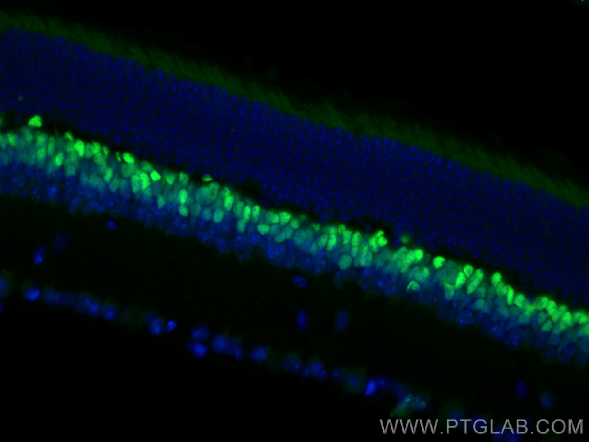 Immunofluorescence (IF) / fluorescent staining of mouse eye tissue using VSX2 Polyclonal antibody (25825-1-AP)
