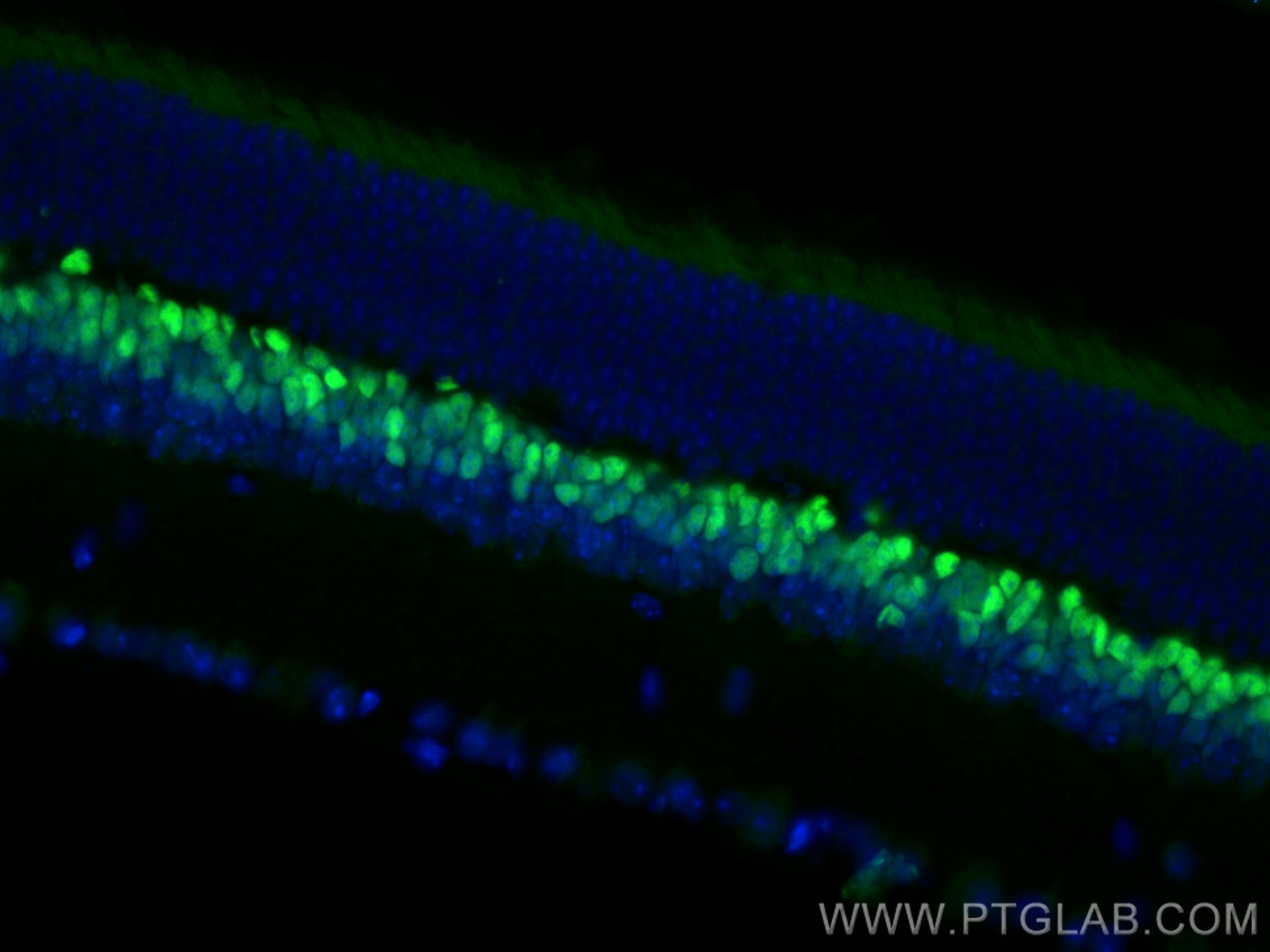 IF Staining of mouse eye using 25825-1-AP