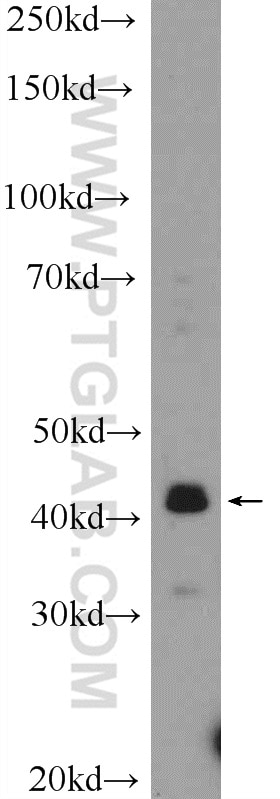 Western Blot (WB) analysis of mouse eye tissue using VSX2 Polyclonal antibody (25825-1-AP)