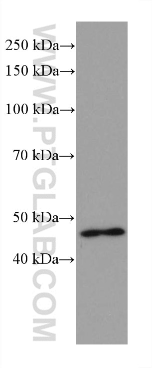 Western Blot (WB) analysis of rat eye tissue using VSX2 Monoclonal antibody (67626-1-Ig)