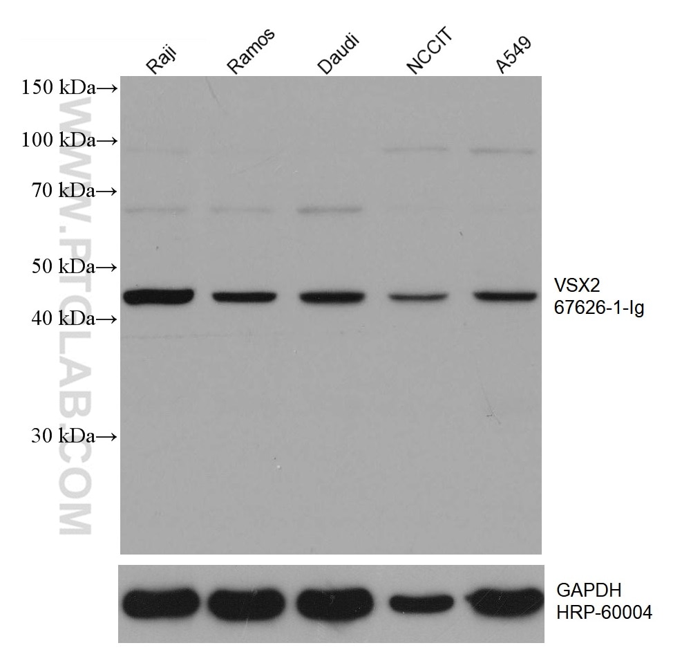 Western Blot (WB) analysis of various lysates using VSX2 Monoclonal antibody (67626-1-Ig)