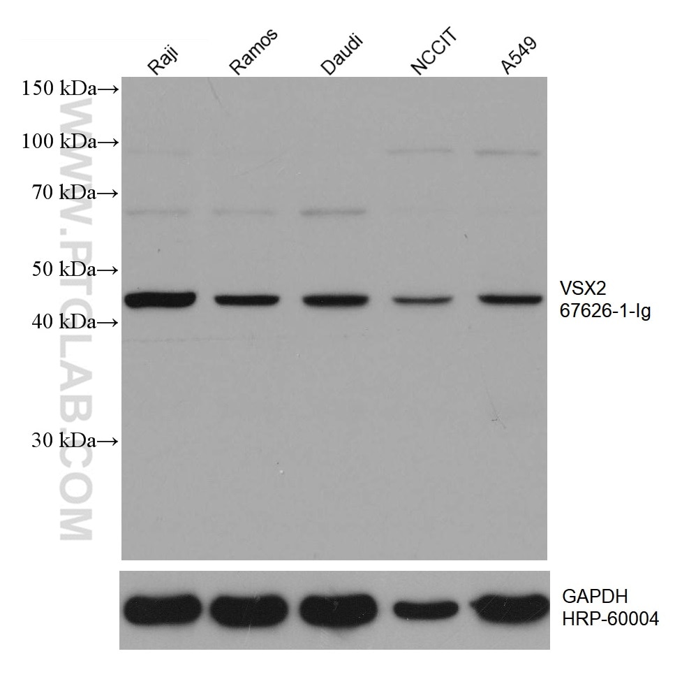 WB analysis using 67626-1-Ig