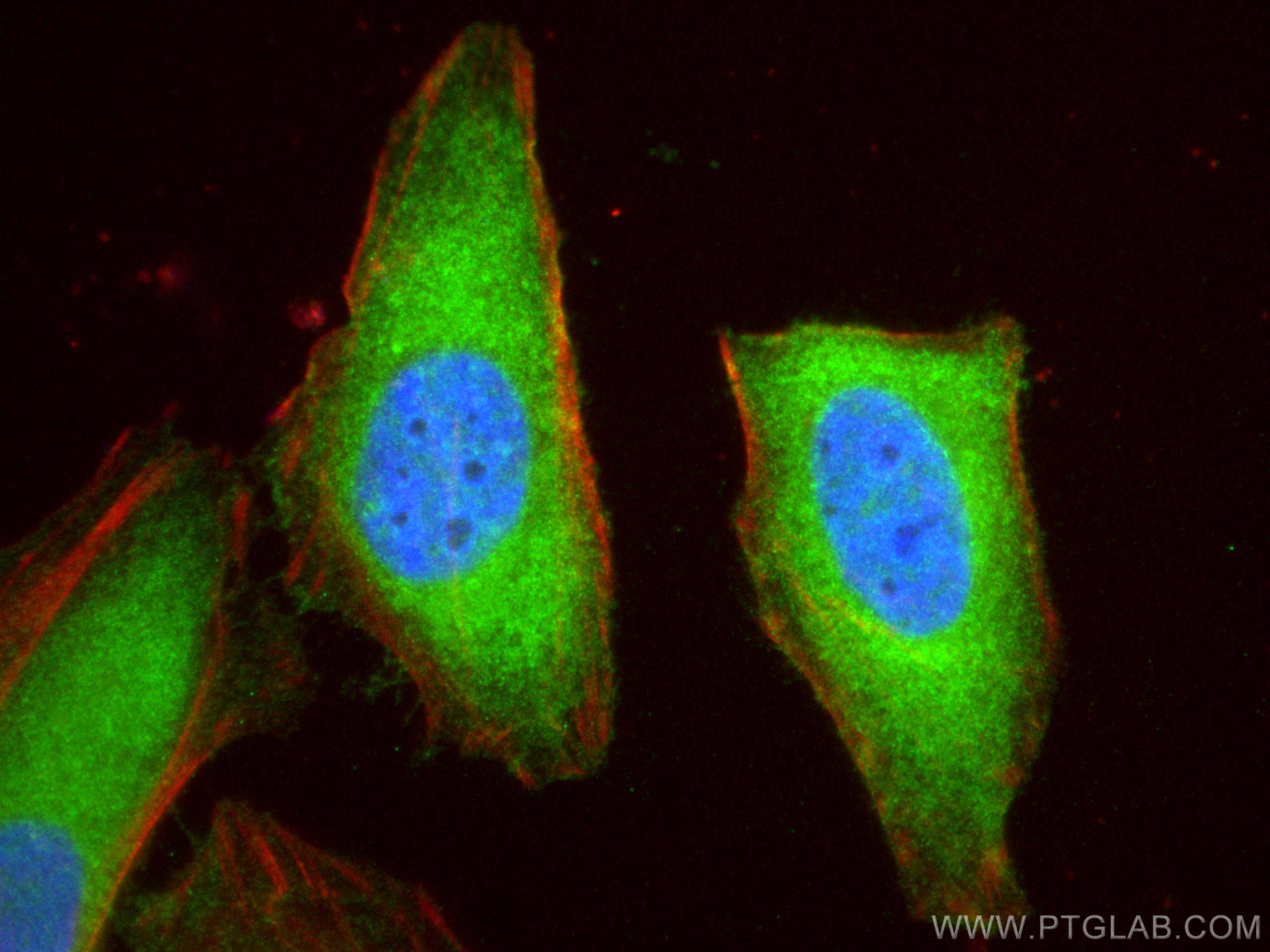 Immunofluorescence (IF) / fluorescent staining of HeLa cells using VTA1 Polyclonal antibody (15786-1-AP)