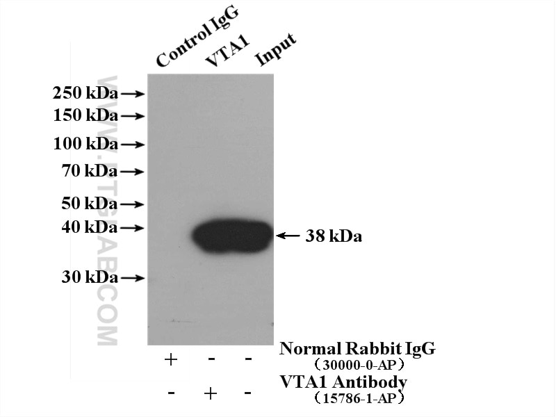 Immunoprecipitation (IP) experiment of HEK-293 cells using VTA1 Polyclonal antibody (15786-1-AP)