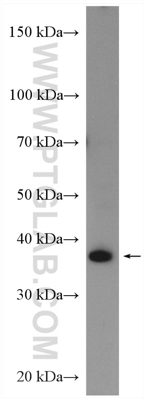 Western Blot (WB) analysis of human urine sample using VTA1 Polyclonal antibody (15786-1-AP)