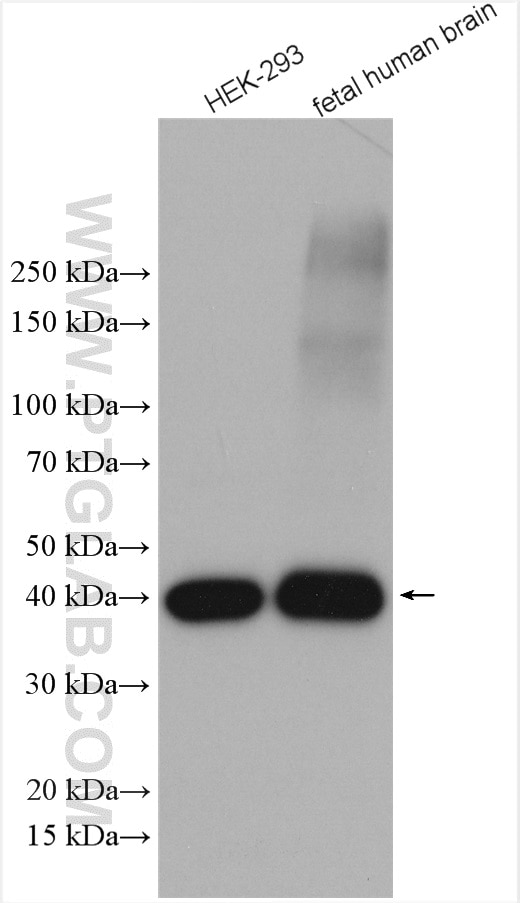 Western Blot (WB) analysis of various lysates using VTA1 Polyclonal antibody (15786-1-AP)