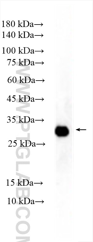Western Blot (WB) analysis of rat brain tissue using VTA1 Polyclonal antibody (15786-1-AP)